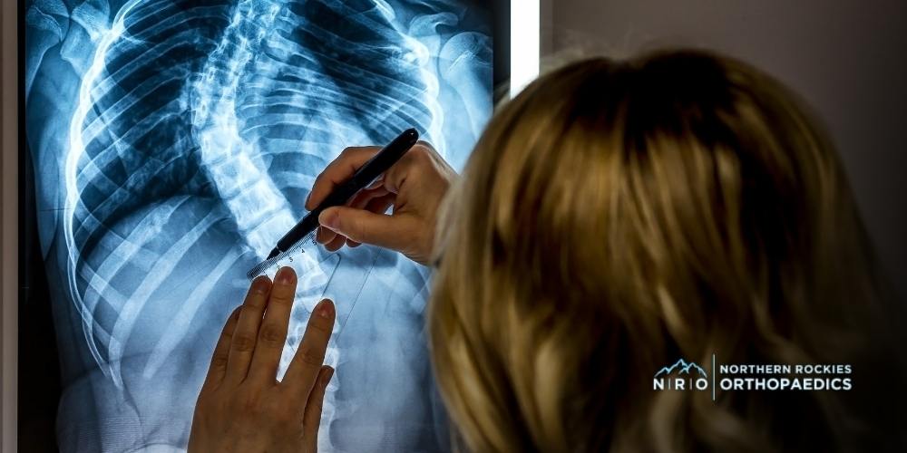 Complex Spine Disorders Missoula