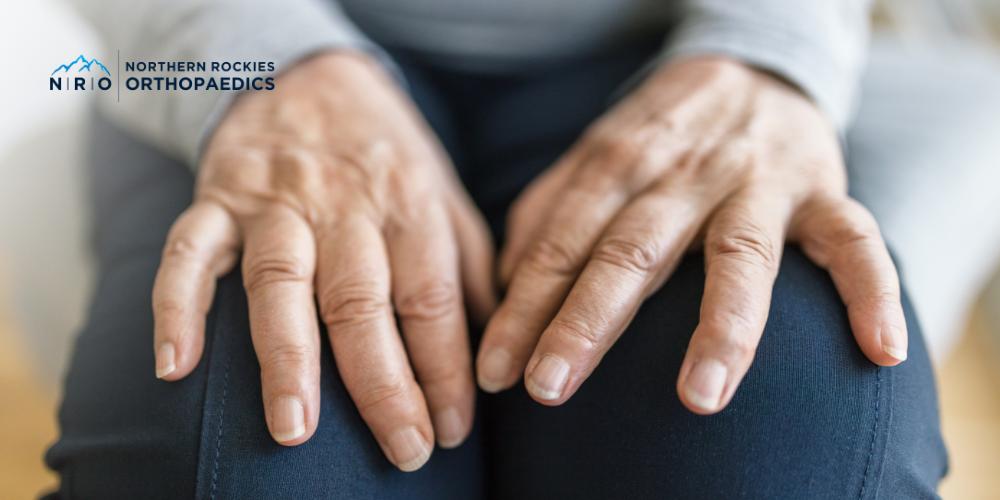 Missoula hand and wrist surgeons