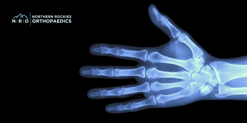 Hand and Wrist Conditions Montana