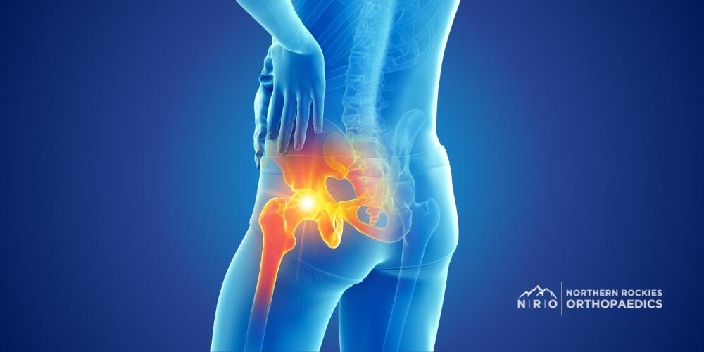 Hip Fractures Missoula, MT