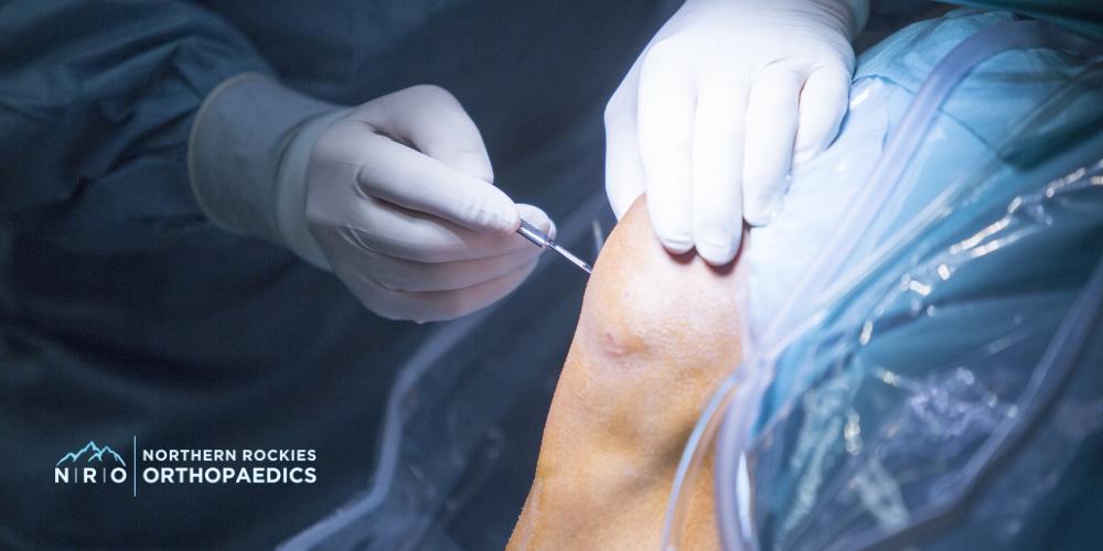 Missoula Montana Knee Surgeons