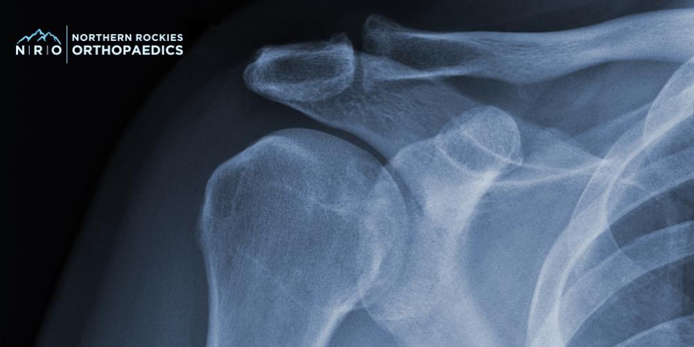 Missoula Shoulder Surgeons