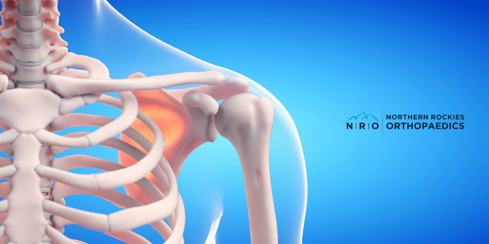 Shoulder Conditions Treated Missoula Montana