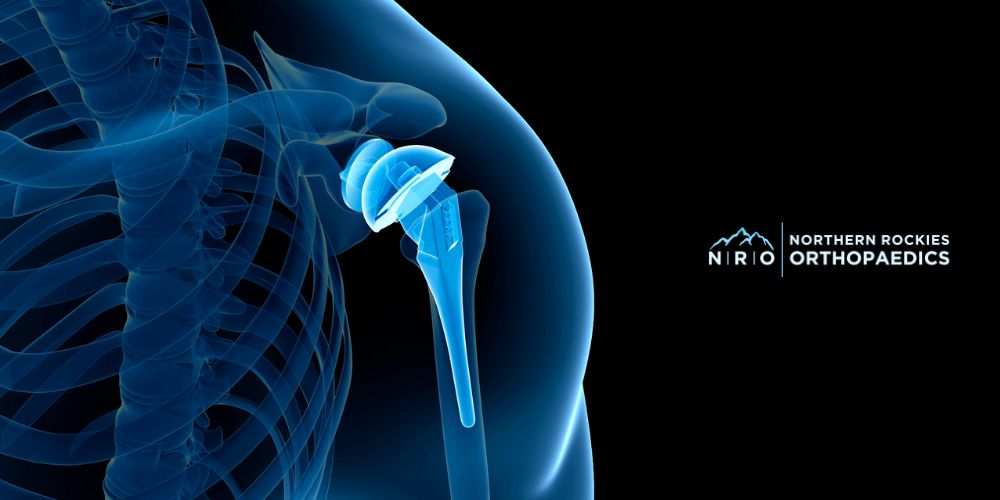 Shoulder Pain Treatments Missoula Montana