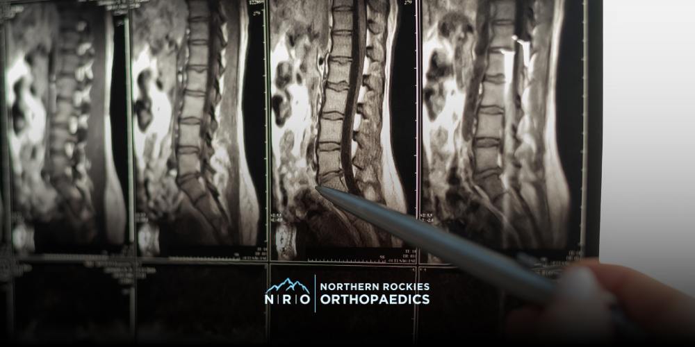 Spine Injuries Missoula Montana