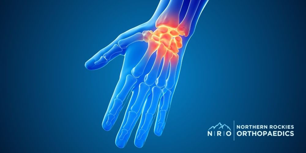 Missoula, MT Hand and Wrist Conditions