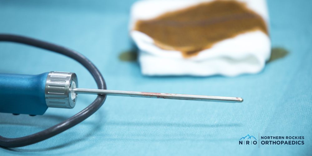 missoula elbow arthroscopy