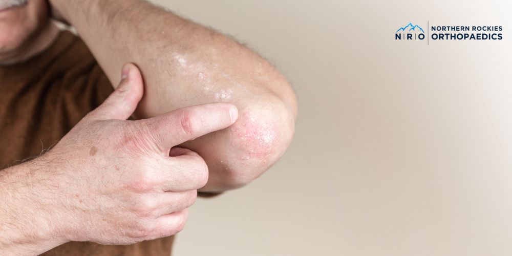 missoula, mt arthritis