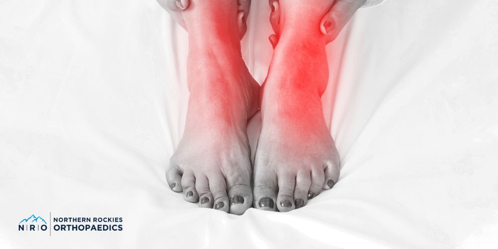 montana ankle arthroscopy